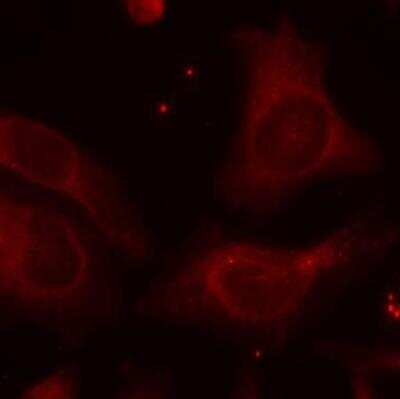 Immunocytochemistry/ Immunofluorescence: NFkB p105/p50 [p Ser927] Antibody [NB100-82069]